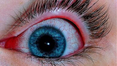 Seis de cada 10 adultos jóvenes en México padecen el síndrome de ojo seco